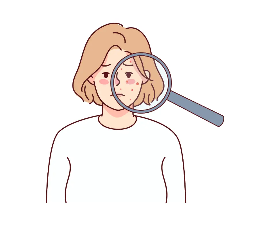 ニキビって何?